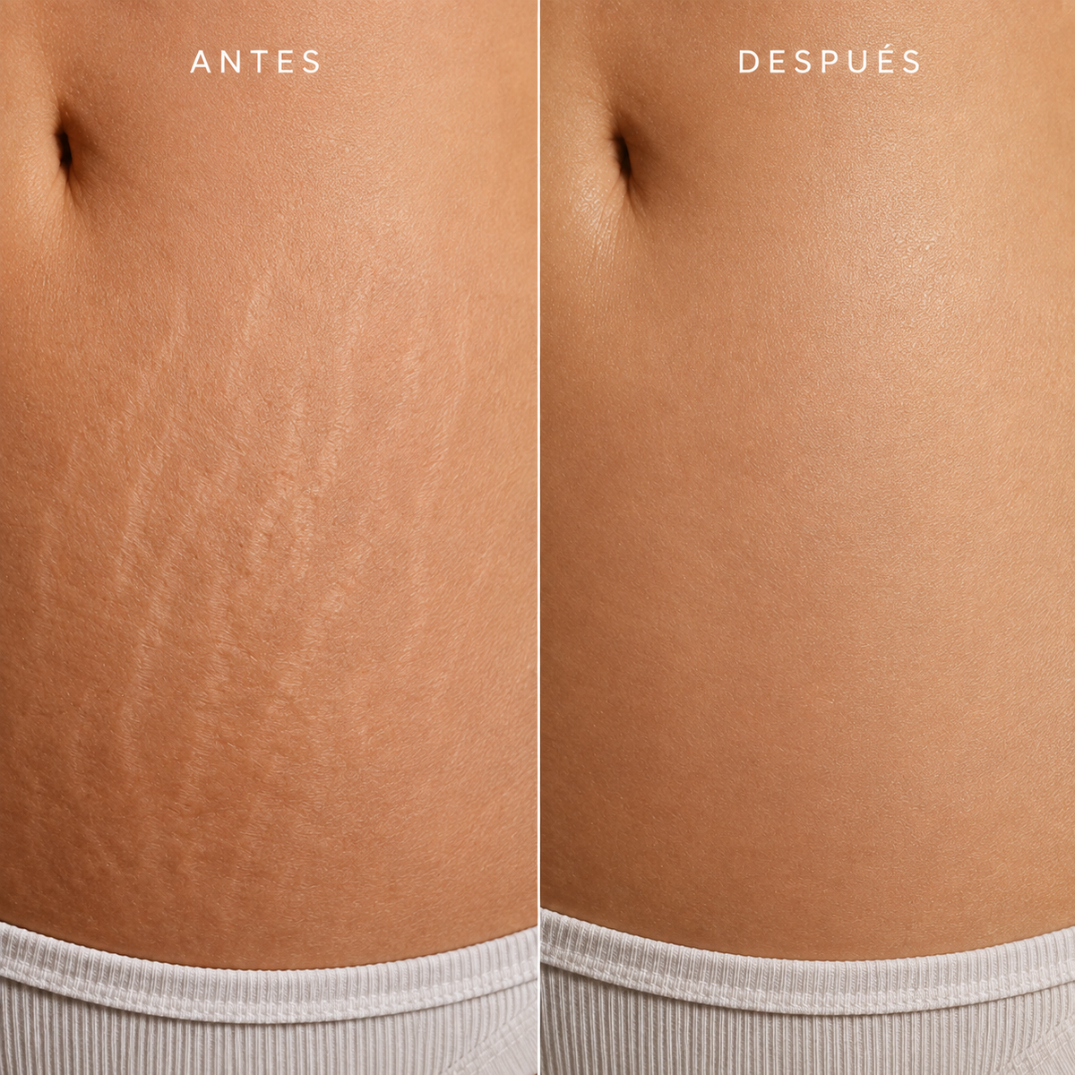 SkinStudio Body Repair – Loción Corporal Anti-Estrías.